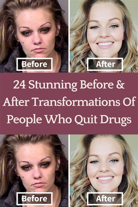 Celebrities Before And After Drugs