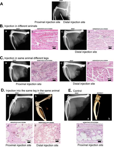 Detection Of Heterotopic Ossification Ho Radiographic And Histologic Download Scientific