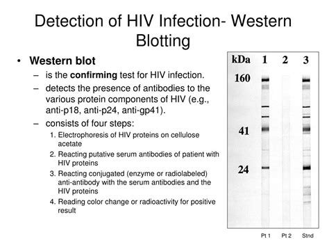 Elisa And Western Blot Test For Hiv Locations Hostlift