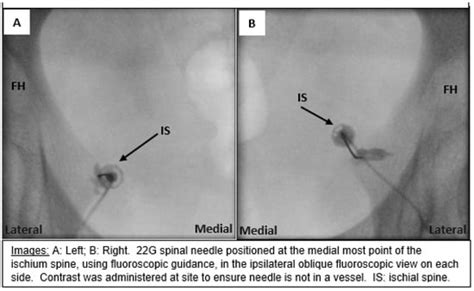 Jcm Special Issue Anesthesia And Pain Management For Women