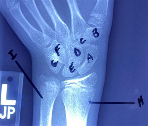 Hand Image Diagram Quizlet