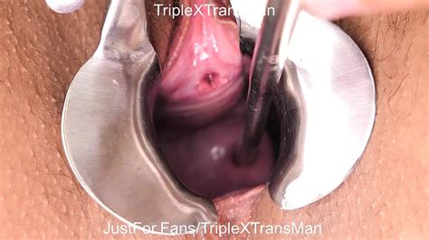 Must Share Moment From Extreme Cervix Penetration Sounds Speculum Uterus Dilation Shemale Porn