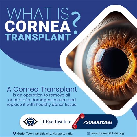 What Are Available Cornea Treatments Lj Eye Institute