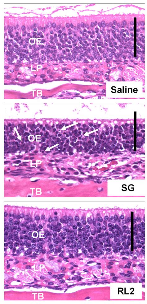 Nasal Histopathology In The Nose Of The B6c3f1 Mouse After Intranasal Download Scientific