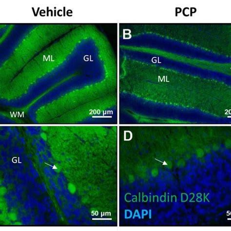 Micrograph Images Showing Purkinje Cells In A Section Of Cerebellar