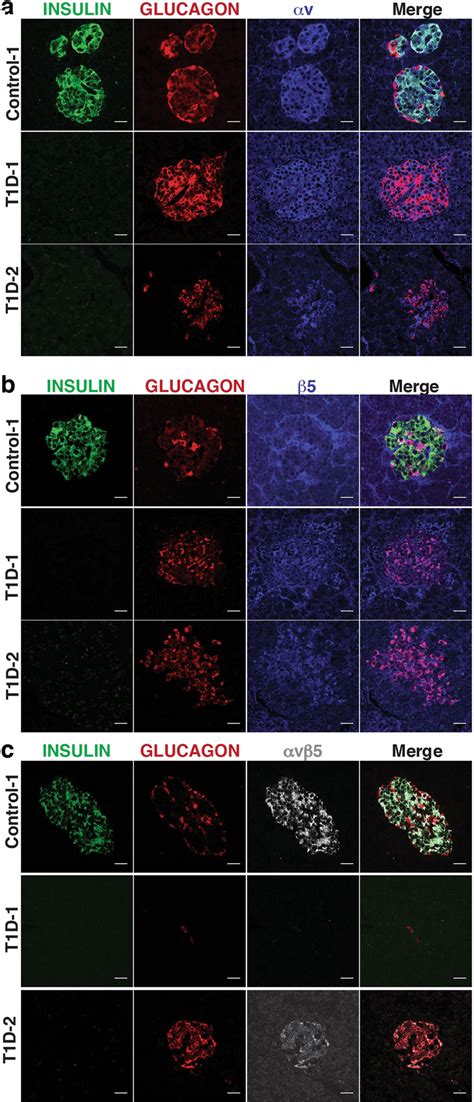 Expression Of The Integrin Heterodimer V And Its Component Subunits