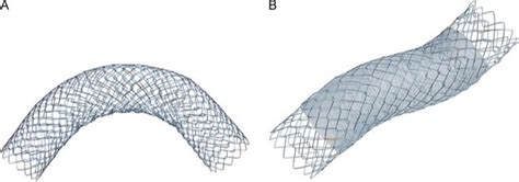 Esophageal Stent Manufacturers And Suppliers In India