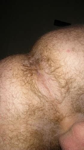 Man Ass Asshole Xnxx Adult Forum