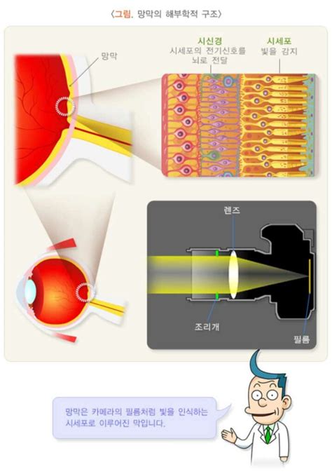 망막박리 증상 6가지 및 원인실명검사치료합병증좋은음식