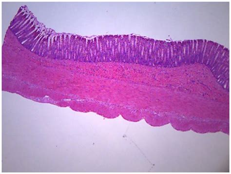 Diagram of Colon histology | Quizlet