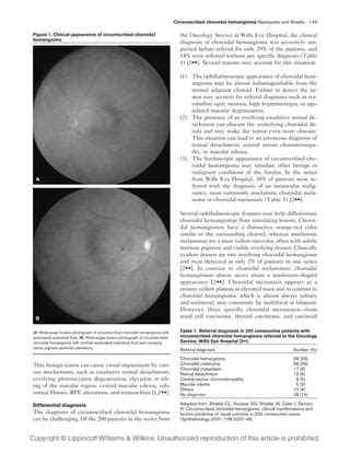 Circumscribed Choroidal Hemangioma PDF