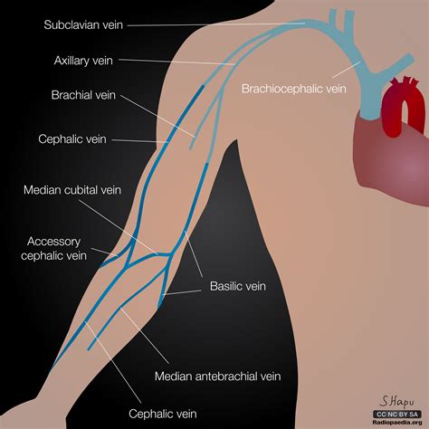 Upper Limb Arterial Doppler