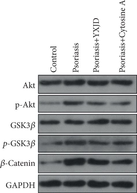 Protein Levels Of P Akt Akt P Gsk Gsk And Catenin And The