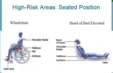 Immobility And Positioning Flashcards Quizlet