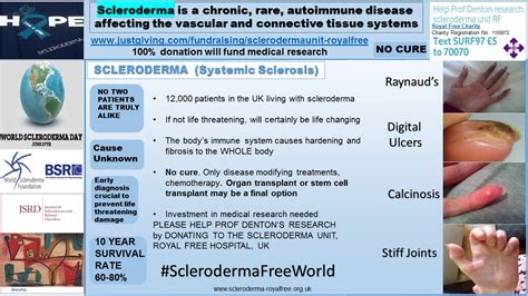 Raynauds Scleroderma Global Patients Raynauds And Scleroderma Infographic