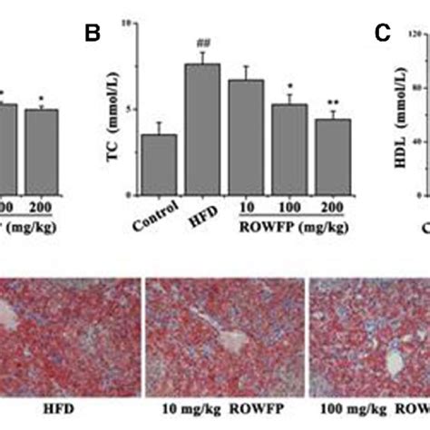 Rowfp Reduces Hfd Induced Liver Damage In C57bl6 Mice Rowfp Reduced