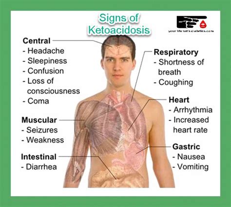 What Is A Diabetic Ketoacidosis Life Saving Info You Need To Read