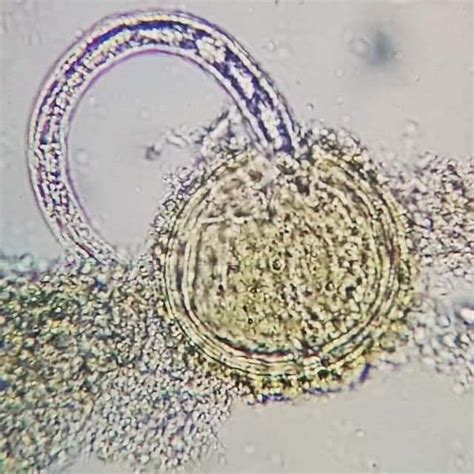 Larva de Ascaris lumbricoides eclosionando | Microbiology