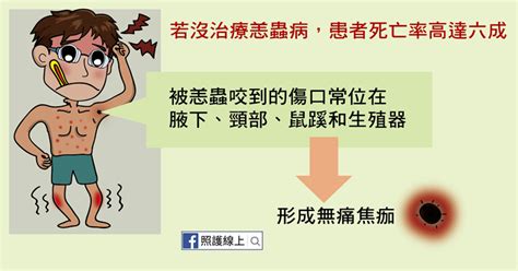 清明掃墓慎防「恙蟲」！死亡率達60、這5縣市病例最多｜健康知識｜新聞｜元氣網