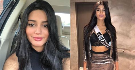 Así Lucía Sthefany Gutiérrez Miss Venezuela Antes De Operarse La