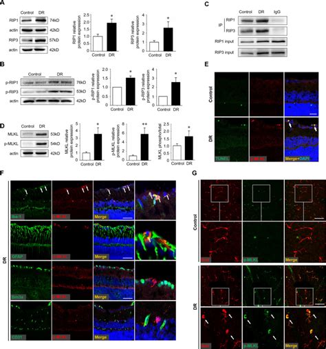 RIP3 Mediated Microglial Necroptosis Promotes Neuroinflammation And