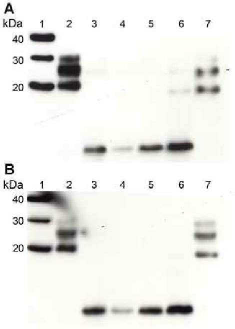 Western Blot Analysis Of Prp Res In Extracts Of Frontal Cortex Tissue