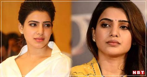 Samantha Ruth Prabhu Skin Disease Presswire18