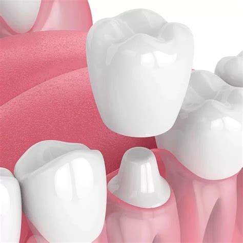 Tu sonrisa con la rehabilitación Oral Clinica Dental Sonrisa Segura