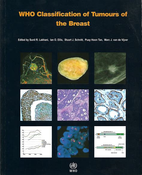 Who Classification Of Tumors Of The Breast