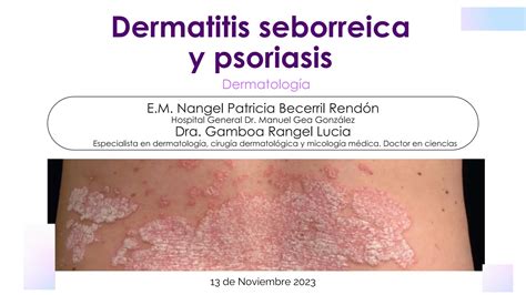 Clase Dermatitis Seborreica Y Psoriasis Pdf