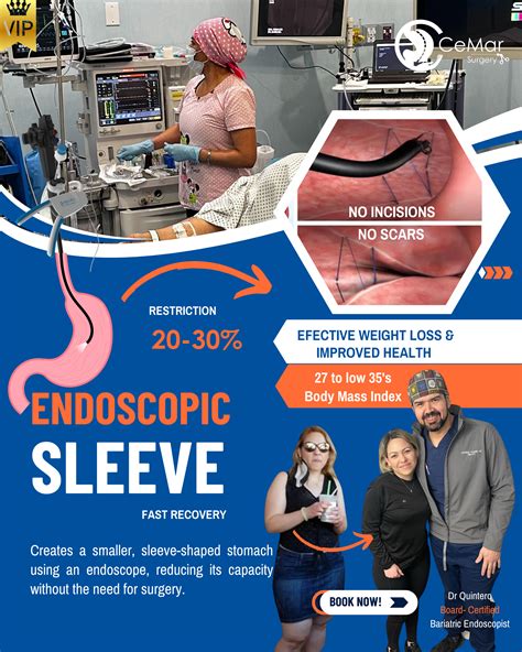 Endoscopic Sleeve Gastroplasty (ESG) - CeMar Surgery Bariatric Blog info
