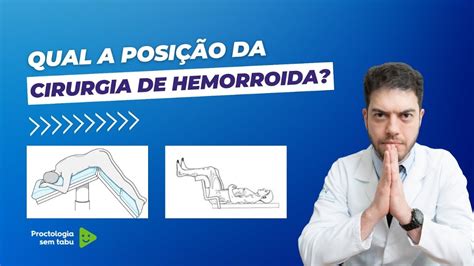 Qual A Posi O Da Cirurgia De Hemorroida Youtube