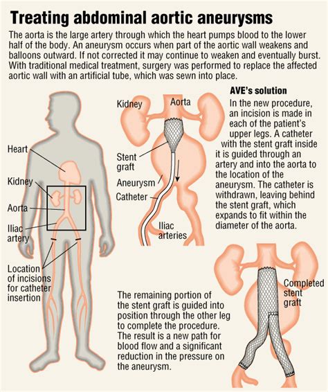 Gary Newman Design for Infographics