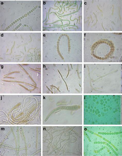 Cyanobacterial strains under microscope: a.Nostoc spongiforme;b. Nostoc ...