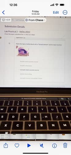 Practical 2 Flashcards | Quizlet 