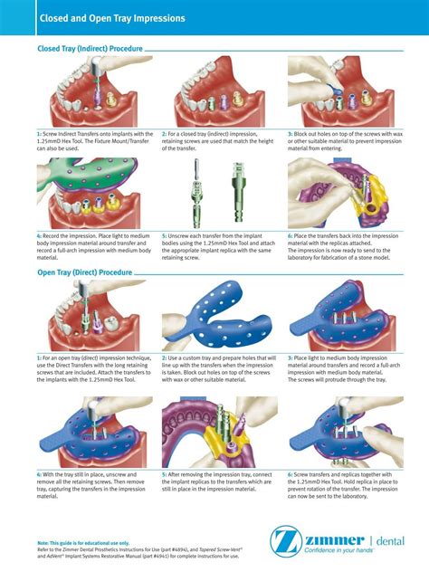 Closed And Open Tray Impressions Zimmer Dental