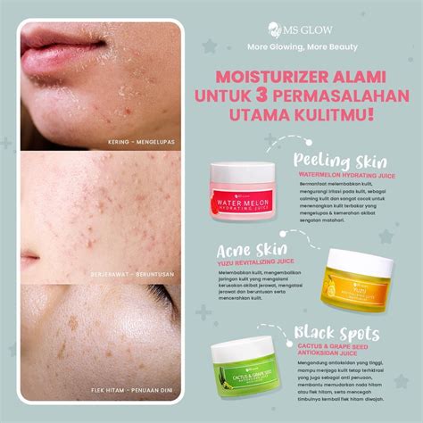 Jual Moisturizer Ms Glow Yuzu Cactus Watermeon Shopee Indonesia