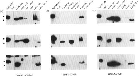 Autoradiograms Of Igg Reactions In Immunoblots Of Representative Sera