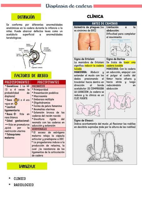 Displasia De Cadera LEK MEDIC UDocz