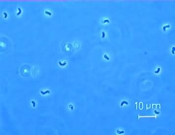 Desulfovibrio - microbewiki