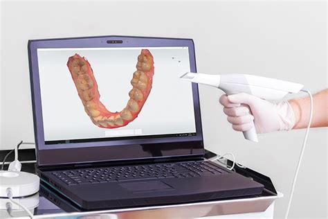 Intraoral Scanning Becoming Dentistry Standard First Choice Dental Lab