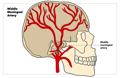 Foramen Spinosum Middle Meningeal Artery