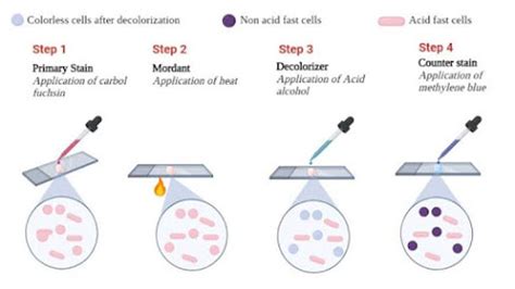 Acid-Fast Staining : Principle, Procedure, Interpretation and Examples.