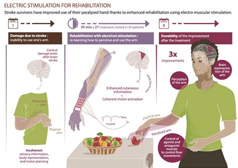 Improved Motor Sensory And Cognitive Recovery After Stroke Sciena