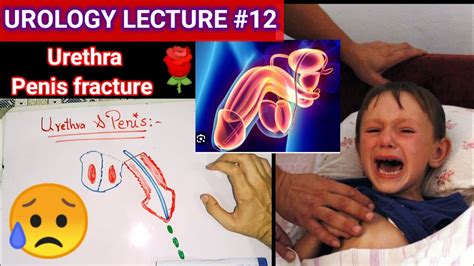 Urology Surgery Lecture Phimosis Paraphimosis Priapism