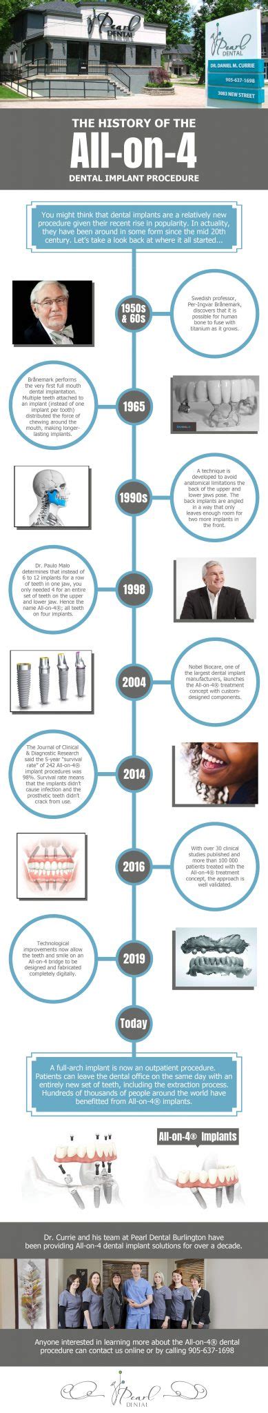 History of All on 4 Dental Implant Procedure | Pearl Dental