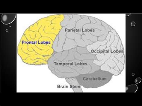 Effects of damage to frontal lobe