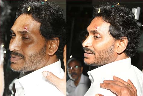 Intense Reactions As Stone Pelter Injures CM Jagan Cinejosh