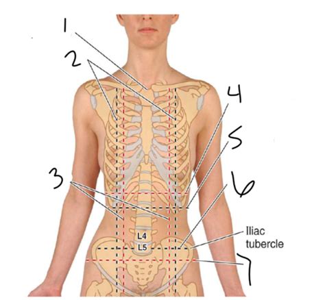 Lecture 1 Abdomen And Anterior Abdominal Wall Flashcards Quizlet