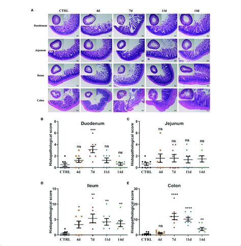 Histological Observation Of DSS Induced Acute Enteritis A